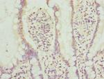 AGPAT2 Polyclonal Antibody