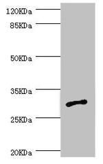 AGPAT2 Antibody in Western Blot (WB)
