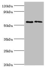 Placental Alkaline Phosphatase Antibody in Western Blot (WB)
