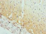 AP2A2 Antibody in Immunohistochemistry (Paraffin) (IHC (P))