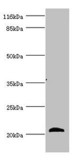Apolipoprotein M Antibody in Western Blot (WB)