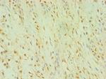 BLK Polyclonal Antibody