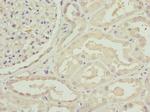 C1GALT1C1 Antibody in Immunohistochemistry (Paraffin) (IHC (P))