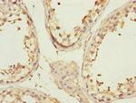CCHCR1 Polyclonal Antibody