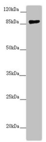 CCHCR1 Antibody in Western Blot (WB)