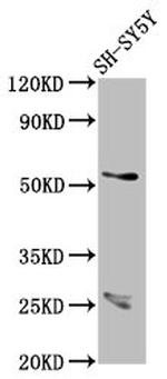 CDR2L Antibody in Western Blot (WB)