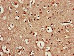 CDX4 Polyclonal Antibody