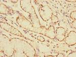 CEACAM4 Polyclonal Antibody