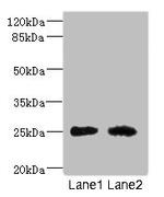 CEACAM4 Antibody in Western Blot (WB)