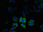 CLIC2 Polyclonal Antibody
