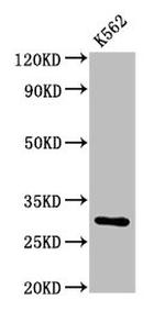 CLIC2 Antibody in Western Blot (WB)