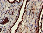 ENTH Polyclonal Antibody