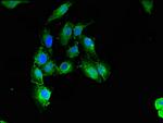 Calponin 3 Antibody in Immunocytochemistry (ICC/IF)