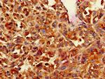 Calponin 3 Antibody in Immunohistochemistry (Paraffin) (IHC (P))