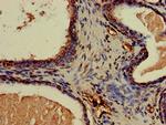 Calponin 3 Antibody in Immunohistochemistry (Paraffin) (IHC (P))