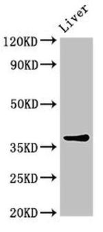 Calponin 3 Antibody in Western Blot (WB)
