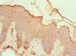 LZIP Antibody in Immunohistochemistry (Paraffin) (IHC (P))
