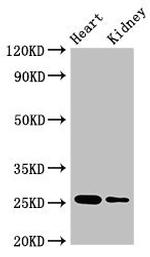 CSH2 Antibody in Western Blot (WB)