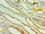 Cathepsin V Polyclonal Antibody
