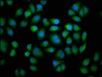 CYP2C19 Polyclonal Antibody