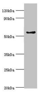 CYP3A5 Antibody in Western Blot (WB)