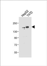 HDAC6 Antibody in Western Blot (WB)