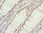 DHDDS Polyclonal Antibody
