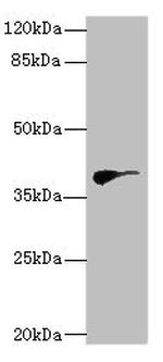 DHDDS Antibody in Western Blot (WB)