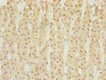 DHRS3 Antibody in Immunohistochemistry (Paraffin) (IHC (P))