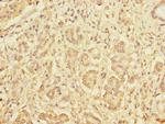 DIAPH2 Polyclonal Antibody