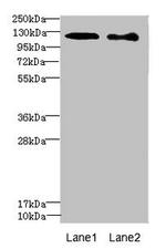 DIAPH2 Antibody in Western Blot (WB)