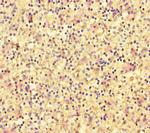 DOK2 Antibody in Immunohistochemistry (Paraffin) (IHC (P))
