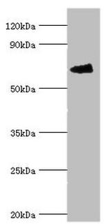 FANCG Polyclonal Antibody