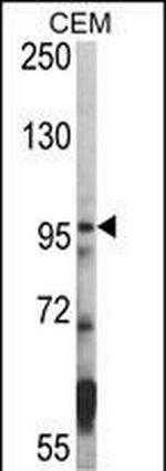 HDAC7 Polyclonal Antibody