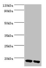 FKBP2 Antibody in Western Blot (WB)