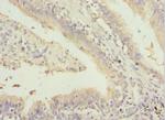 GABRR1 Antibody in Immunohistochemistry (Paraffin) (IHC (P))
