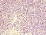 GABRR1 Polyclonal Antibody