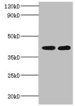 GLT8D2 Antibody in Western Blot (WB)
