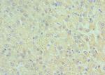 GluD2 Polyclonal Antibody