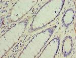 GOSR1 Antibody in Immunohistochemistry (Paraffin) (IHC (P))
