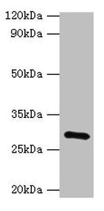 GOSR1 Antibody in Western Blot (WB)