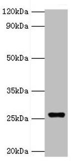 GSTA4 Antibody in Western Blot (WB)