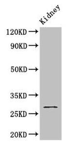 GSTM3 Antibody in Western Blot (WB)