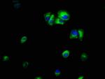 ILK Antibody in Immunocytochemistry (ICC/IF)