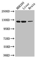 GUCY2C Polyclonal Antibody
