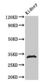 Phospho-Histone H1.5 (Ser188) Antibody in Western Blot (WB)
