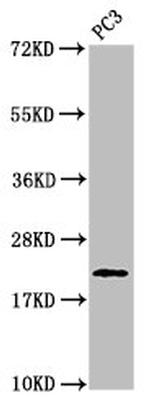 Phospho-Histone H1.3 (Thr146) Antibody in Western Blot (WB)