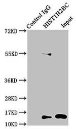 Butyryl-Histone H2B (Lys5) Antibody in Immunoprecipitation (IP)