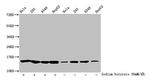 Butyryl-Histone H2B (Lys5) Antibody in Western Blot (WB)