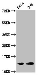 Glutaryl-Histone H2B (Lys5) Antibody in Western Blot (WB)